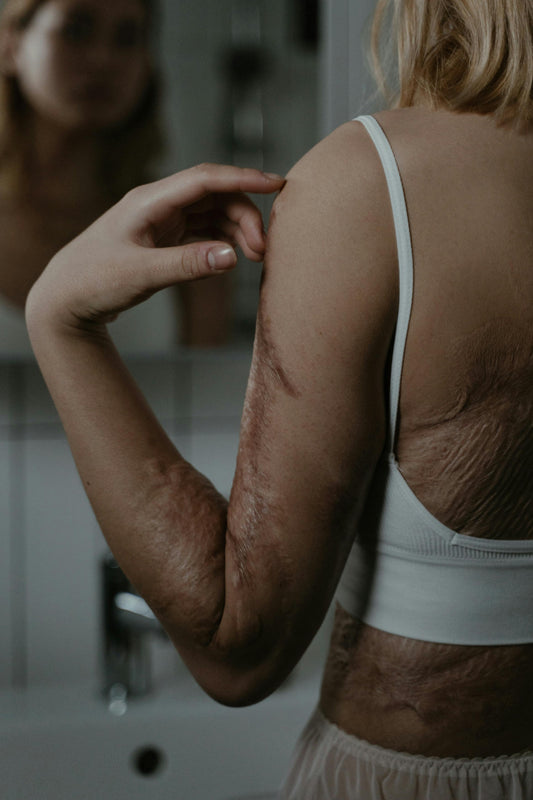 Reconnecting With Your Body After Trauma Or Long-Term Discomfort